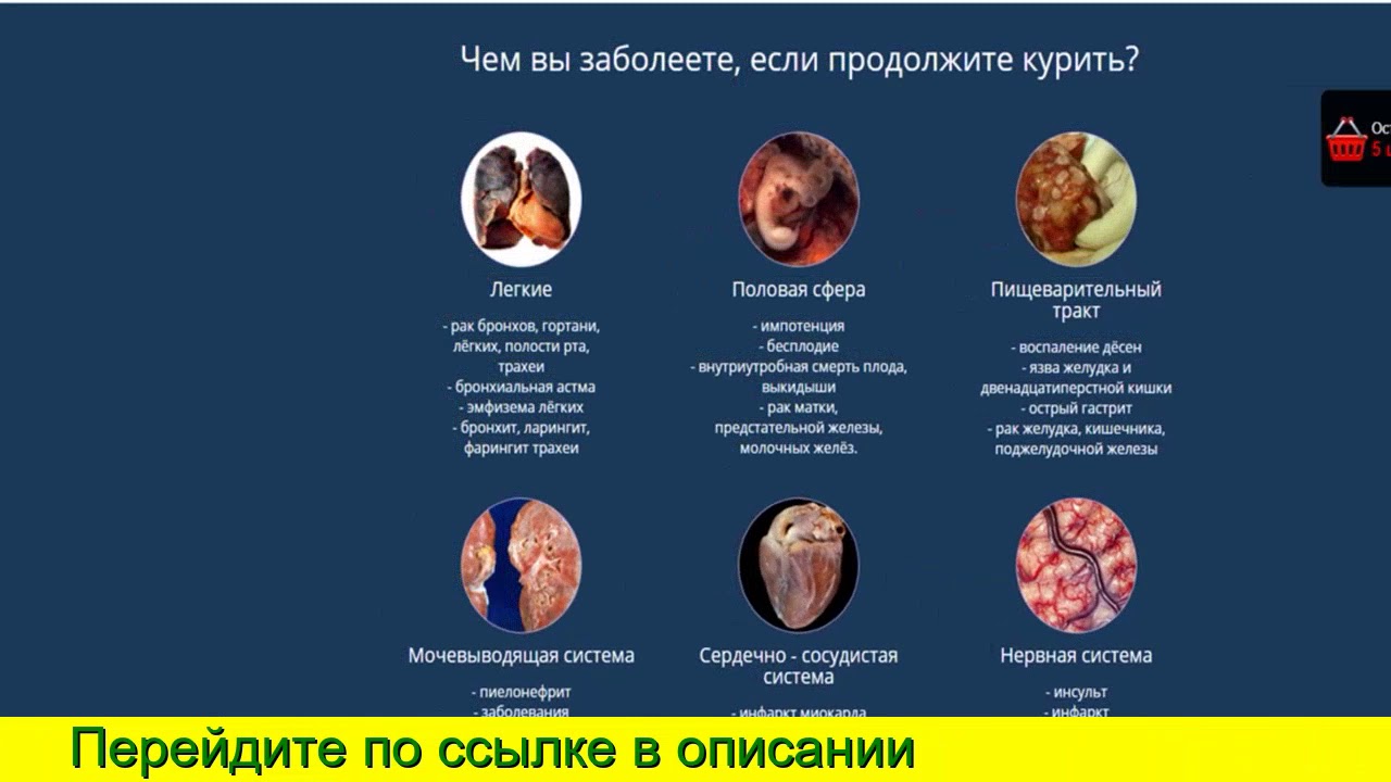 ВИАГРА отзывы - ua